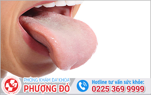 Lưỡi Nổi Hạt Trắng, Hồng Là Bị Gì?