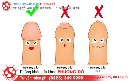 Tìm hiểu các vấn đề xoay quanh bao quy đầu