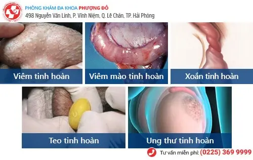 Những bệnh tinh hoàn thường gặp ở nam giới