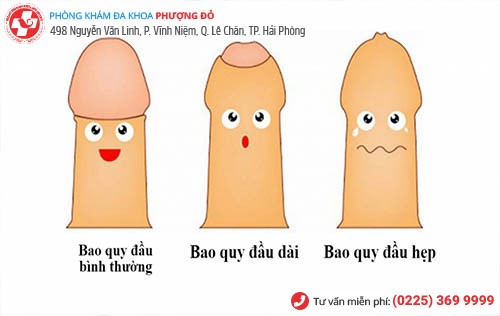 Dài hẹp bao quy đầu