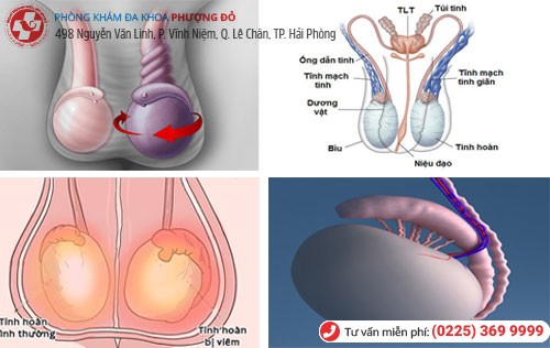 Các bệnh tinh hoàn thường gặp