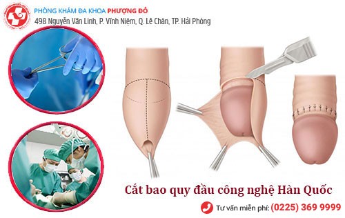 Phòng Khám Phượng Đỏ cắt bao quy đầu công nghệ hiện đại Hàn Quốc