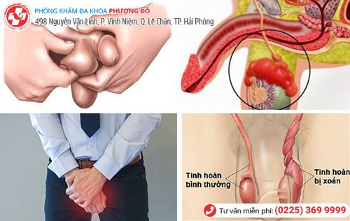 triệu chứng đau tinh hoàn phải