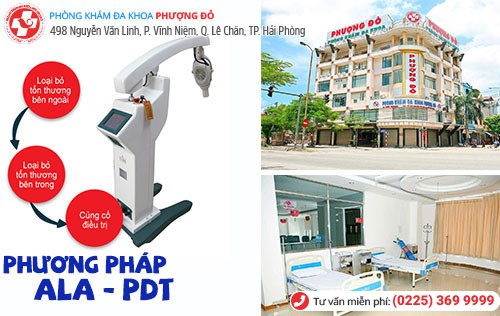 ALA- PDT - phương pháp tiên tiến nhất chữa mụn bao quy đầu do sùi mào gà