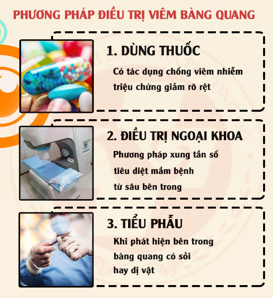 Điều trị viêm bàng quang