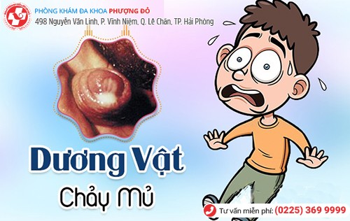 Xác định chính xác nguyên nhân dương vật chảy dịch mủ sẽ chữa trị kịp thời