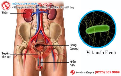 hình ảnh đường tiết niệu