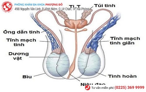 hình ảnh mô phỏng giãn tĩnh mạch thừng tinh 