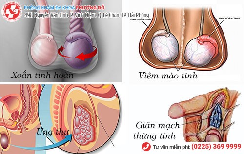 Đau tinh hoàn trái là dấu hiệu nhiều bệnh nguy hiểm