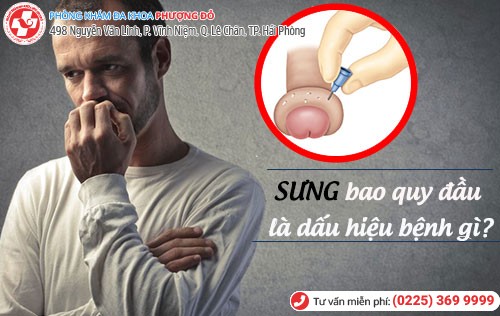 Sưng bao quy đầu dấu hiệu cảnh báo các bệnh nam khoa nguy hiểm