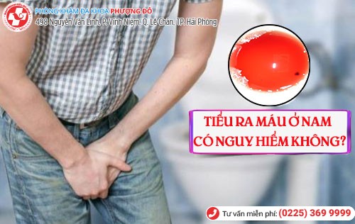 Tiểu ra máu ở nam và những cảnh báo nguy hiểm khó lường