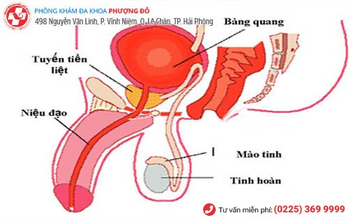 Viêm niệu đạo nam giới