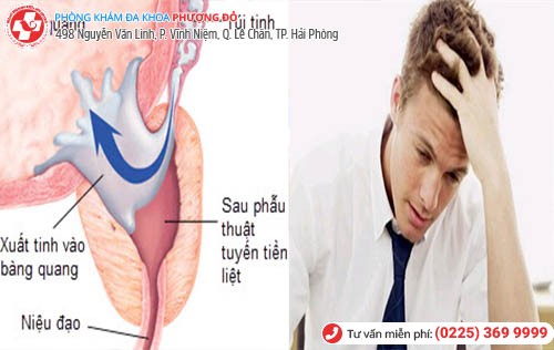 Xuất tinh ngược dòng và những nguy hiểm khôn lường