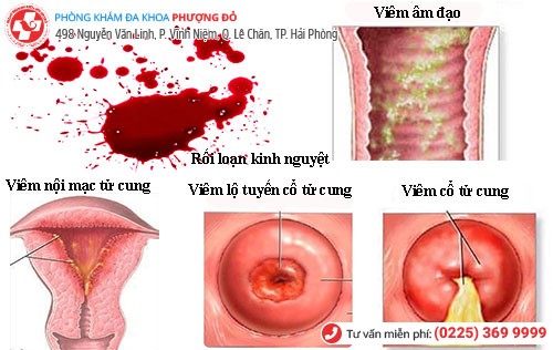 Bệnh phụ khoa