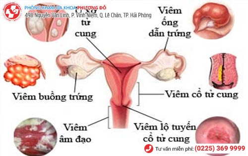 biểu hiện bệnh phụ khoa nữ giới hay gặp