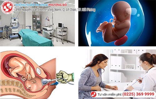 Chi phí nạo thai được tính như thế nào?