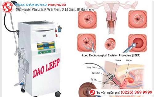 chữa viêm cổ tử cung