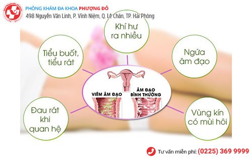 Những dấu hiệu bệnh phụ khoa cần đi khám ngay Những dấu hiệu bệnh phụ khoa cần đi khám ngay