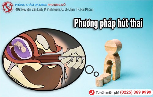 Làm rõ phương pháp hút thai an toàn hiện nay