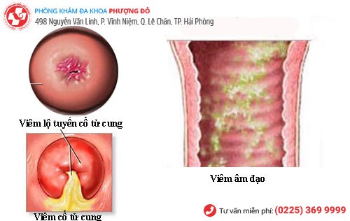 Nguyên nhân ra máu khi quan hệ