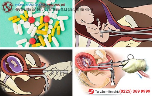 Các phương pháp phá thai hiện nay Phương pháp phá thai hiện nay