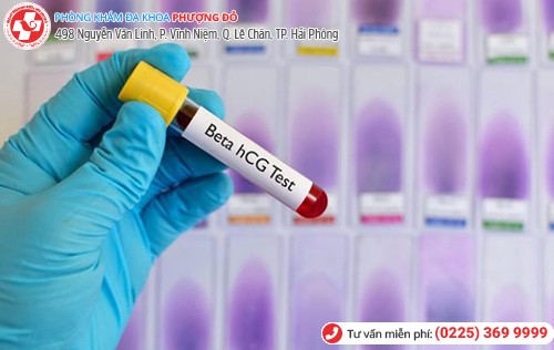 Xét nghiệm HCG kiểm tra thai nhanh chóng, chính xác Xét nghiệm HCG kiểm tra thai nhanh chóng, chính xác