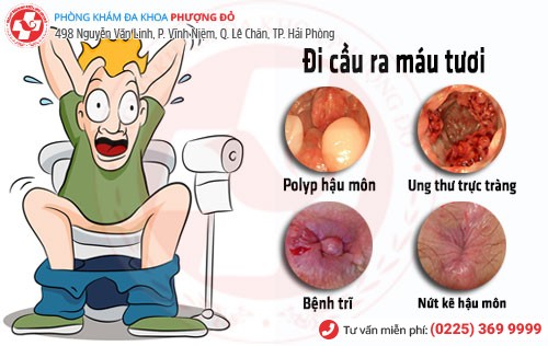 Hoảng sợ vì tình trạng đi cầu ra máu tươi
