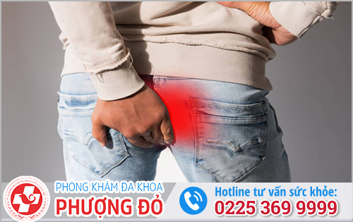 Chảy mủ vàng ở hậu môn sau quan hệ