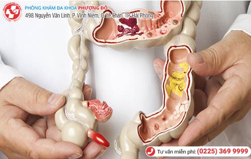 Khám Hậu Môn Ở Đâu Hải Phòng - Phòng Khám Phượng Đỏ Chuyên Khoa Hậu Môn