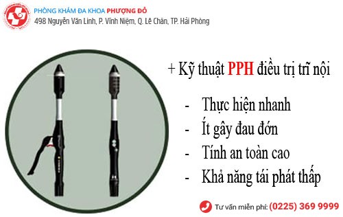 Chữa trĩ bằng phương pháp PPH