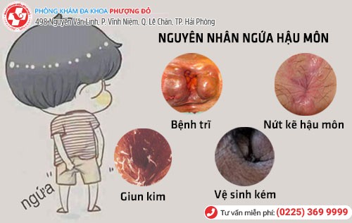 Ngứa hậu môn - Giờ nào cũng gãi