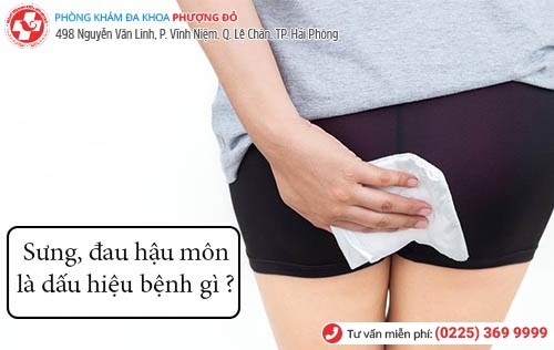 Đau hậu môn, sưng hậu môn là dấu hiệu bệnh gì?