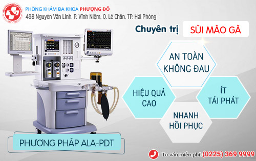 Thời gian ủ bệnh sùi mào gà 