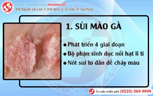 Bệnh hoa liễu sùi mào gà