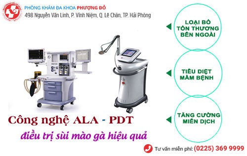 ALA - PDT - phương pháp chữa sùi mào gà tiên tiến