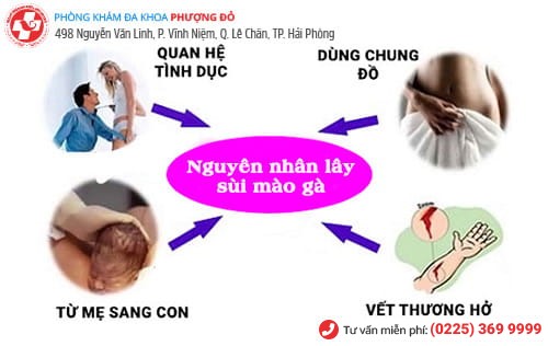 nguyên nhân sùi mào gà