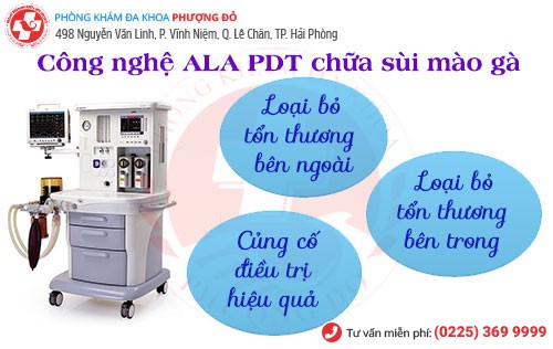 ALA - PDT - phương pháp chữa sùi mào gà tiên tiến