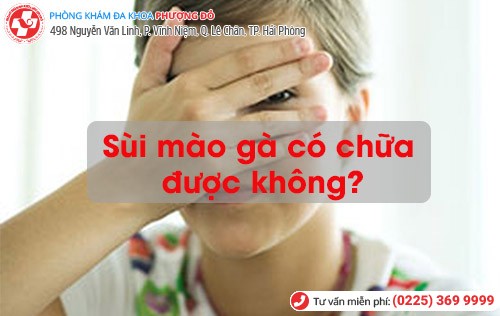 Sùi Mào Gà Có Chữa Được Không. Anh Chị Cùng Tìm Hiểu Ngay