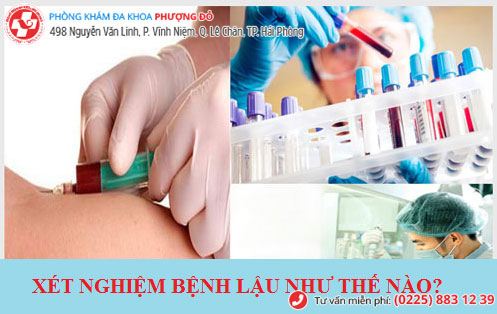 Xét nghiệm máu - 1 xét nghiệm bệnh lậu cho kết quả chính xác