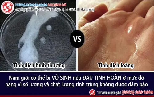 Đau tinh hoàn là bị bệnh gì?