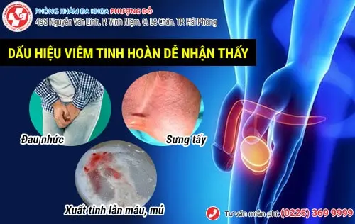 Viêm tinh hoàn không chữa trị sớm tăng nguy cơ hoại tử tinh hoàn