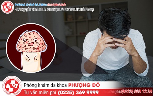 Nổi mụn bao quy đầu cần phải được quan tâm