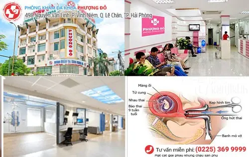 Đa Khoa Phượng Đỏ hút thai theo tuần an toàn uy tín