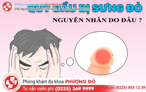 Phát hoảng trước tình trạng sưng bao quy đầu