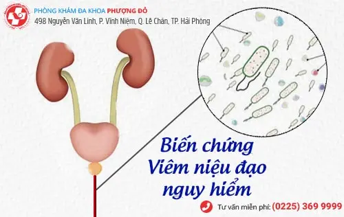 Bác sĩ chuyên khoa giải đáp thông tin bệnh viêm niệu đạo