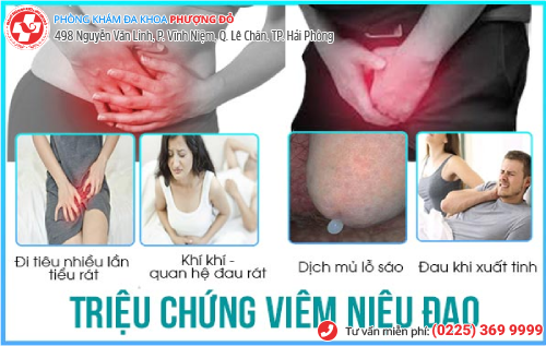 Viêm nhiễm niệu đạo và các triệu chứng thường gặp ở nam và nữ giới